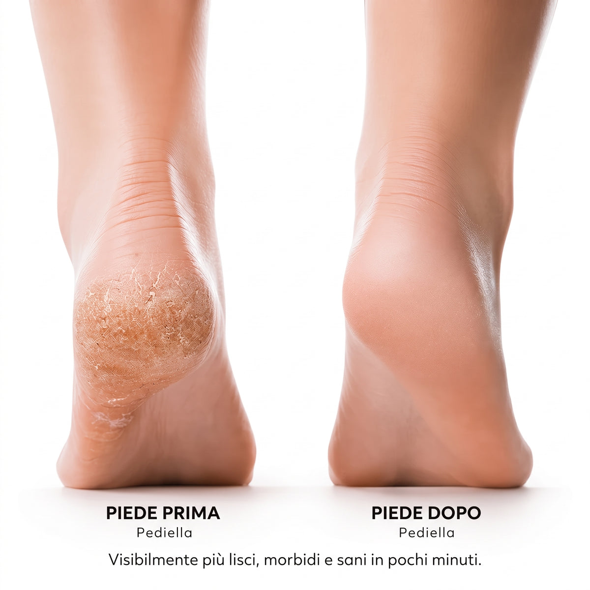 Pediella™ Levigatore Elettrico per Calli e Pelle Secca dei Piedi